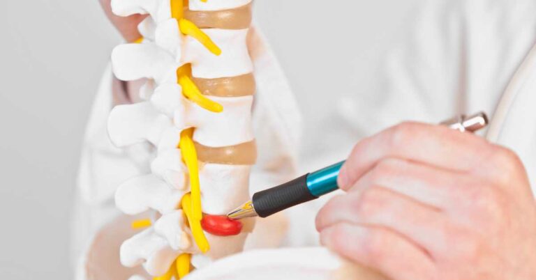 can an auto accident cause a herniated disc